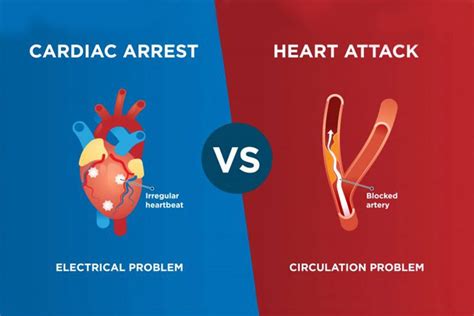 Understanding Aeds How They Work And What They Look For In Cardiac