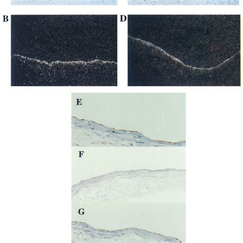 Smad And Smad Are Expressed In Human Vascular Endothelium In Vivo