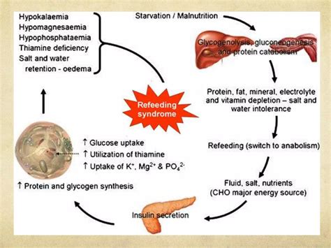 Refeeding Syndrome Ppt Free Download