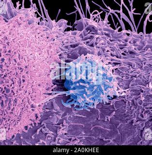 Prostate Cancer Cells Sem Stock Photo Alamy