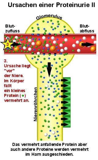 Eiweiß im Harn Proteinurie Details