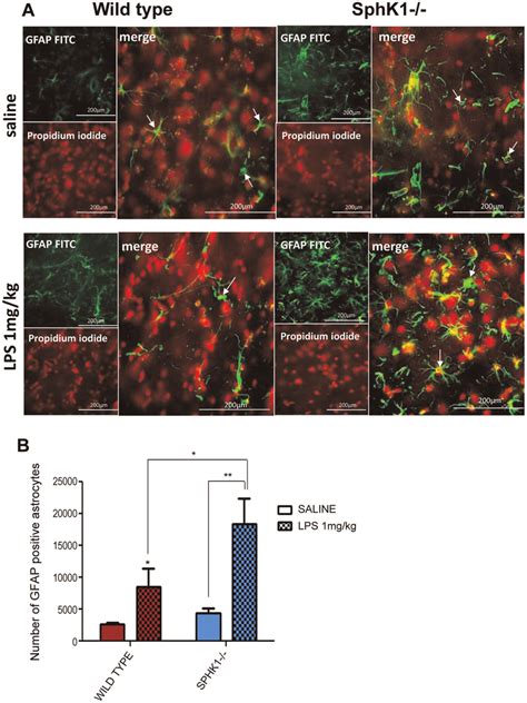 A Immunohistochemistry Of The Frozen Sections Of The Brains Gfap