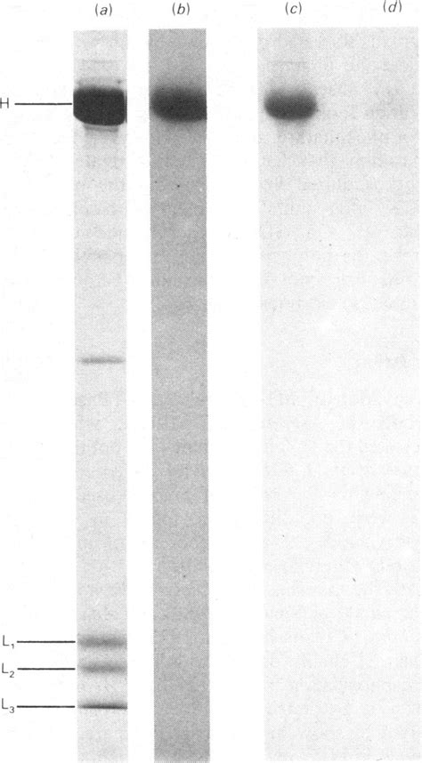 Sdspolyacrylamide Gel Electrophoresis Of Download Scientific Diagram