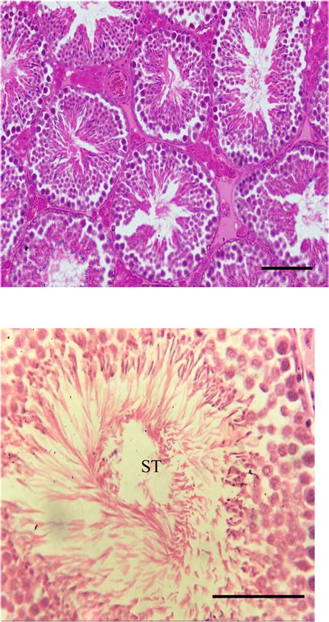 Light Micrographs Of Sections In The Testicular Tissues Of Control Rat