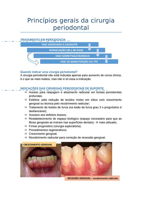 Cirurgia Periodontal Princípios gerais da cirurgia periodontal