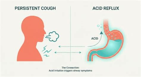 gerd cough   treatment guide