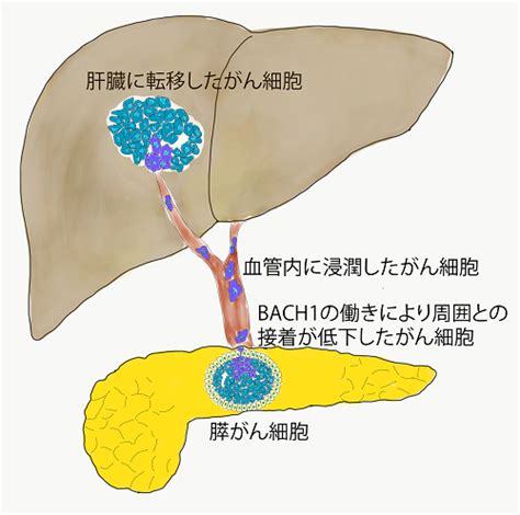 すい臓がん細胞の転移を促進するスイッチを発見 ‐b プレスリリース・研究成果 東北大学 Tohoku University