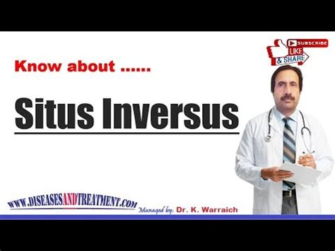 Situs Inversus : Causes, Diagnosis, Symptoms, Treatment, Prognosis ...