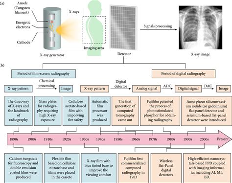 Recent Development In X Ray Imaging Technology Future And Challenges