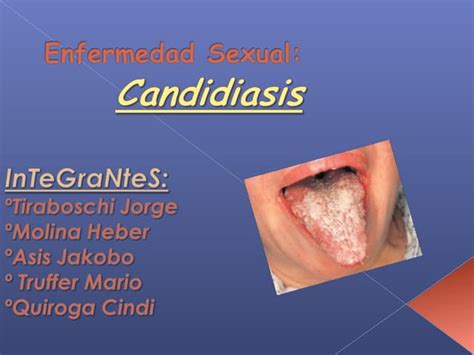 Candidiasis 4 A Ppt