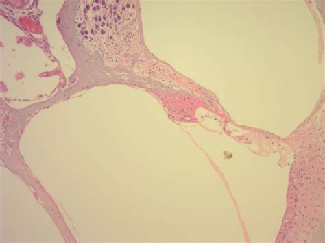 Cochlea Histology Diagram | Quizlet