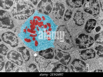 Metaphase Cell Division Colour Transmission Electron Micrograph TEM