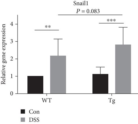 TL1A promotes epithelial to mesenchymal transition (EMT) via IL-13 and ...