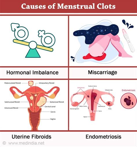 Is It Normal To Have A Period With Blood Clots at Howard Nereida blog