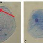 Micronucleus In Oral Mucosa Cells Ocular X Objective X