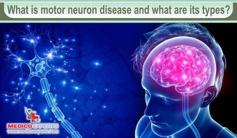 Motor Neuron Disease Treatment in India: Current Options