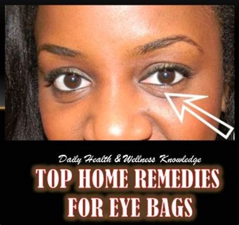 DAILY HEALTH & WELLNESS KNOWLEDGE: TOP HOME REMEDIES FOR EYE BAGS