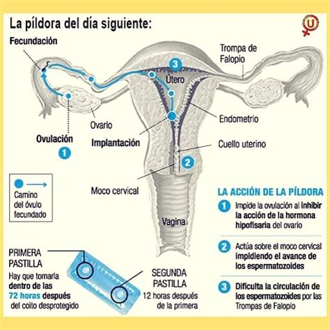 Descubrir 63 Imagen Pastilla Del Dia Siguiente Necesita Receta Medica