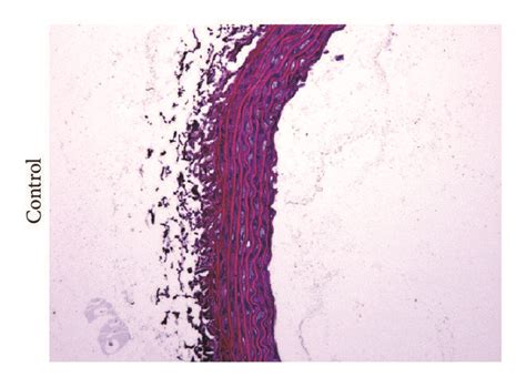 Von Kossa And Hematoxylin And Eosin He Staining For Aortic Sections Download Scientific