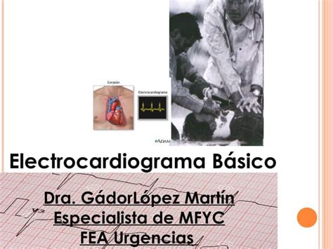 Electrocardiograma Ecg B Sico Ppt