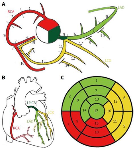 Rca Anatomy - Anatomical Charts & Posters