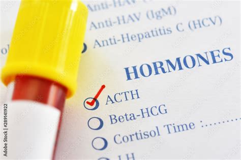 Blood sample tube with laboratory requisition form for adrenocorticotropic hormone or ACTH test ...