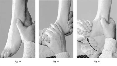 Figure 2 From Synovial Impingement In The Ankle A New Physical Sign