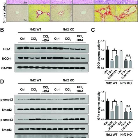 Ida Attenuates The Progression Of Liver Fibrosis In Ccl Treated Mice