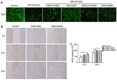 Effect Of CdM On HdF Proliferation And Migration A HdFs Were Treated