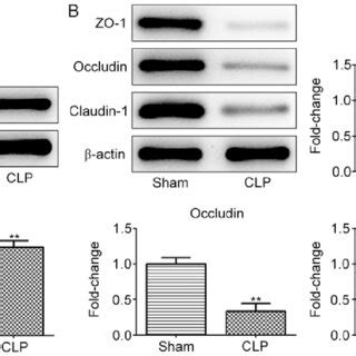 Effects Of Gsk On Tight Junction Protein Expression In The