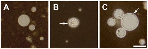 Blastocystis Hominis Life Cycle