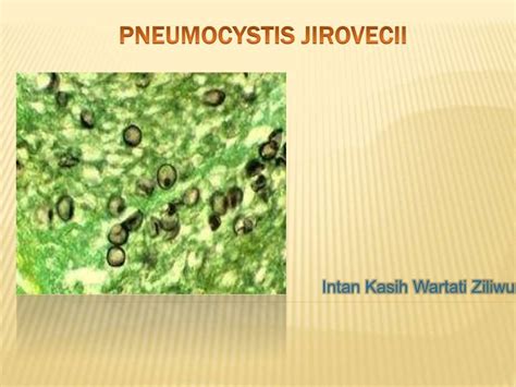 Pneumocystis Jiroveci Life Cycle