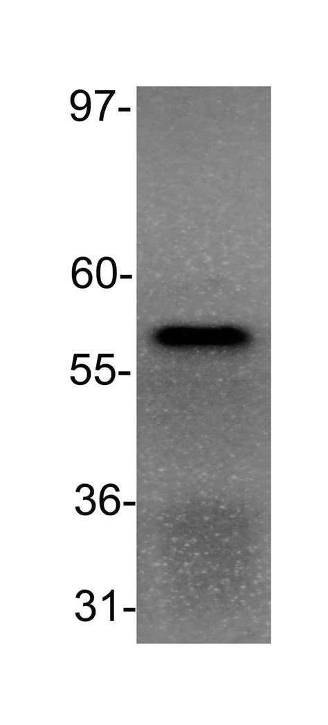 Ppar Alpha Nr C Antibody B Ppar Bsa Free Nb Novus