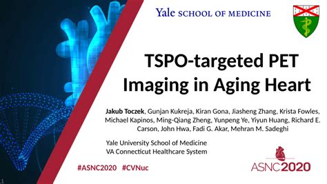 Pdf Tspo Targeted Pet Imaging In Aging Heart