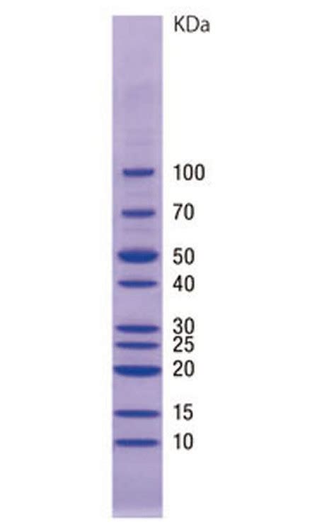 Using unstained protein ladder western blot - frosdmk