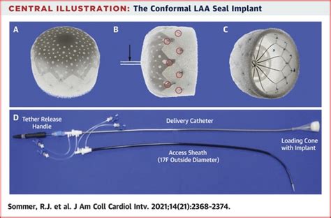 Conformal Left Atrial Appendage Seal Device For Left Atrial Appendage