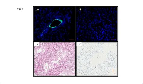 Re Endothelialization Of Liver Xenografts Utilizing Human Endothelial