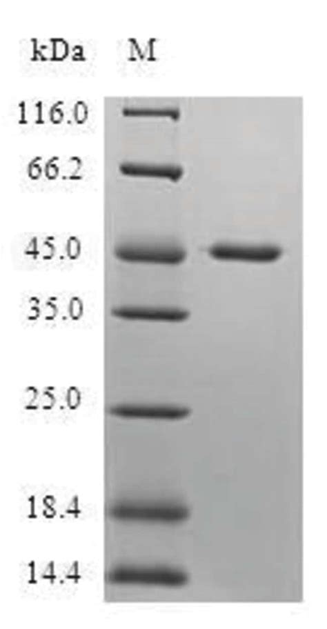 enQuireBio Recombinant Human Protein Dr1 Protein 10μg Fisher Scientific