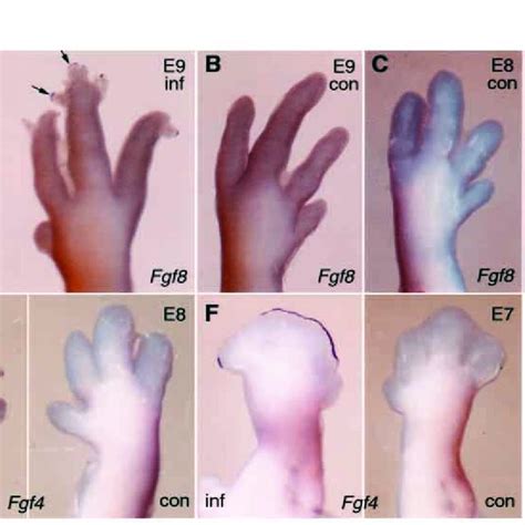 Noggin Expression Is Induced By Ectopic Shh Endogenous Noggin