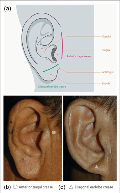 Ear Anatomy Pictures