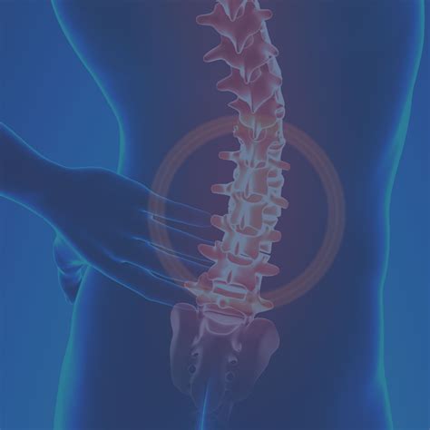 Spinal Disc Degeneration | Causes & Treatment | Dr. Chris Homan