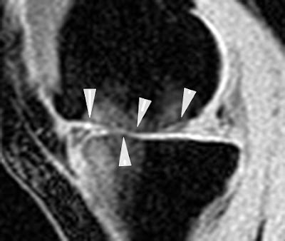 Medview Medical Imaging Consultancy Info Page Imaging The Articular