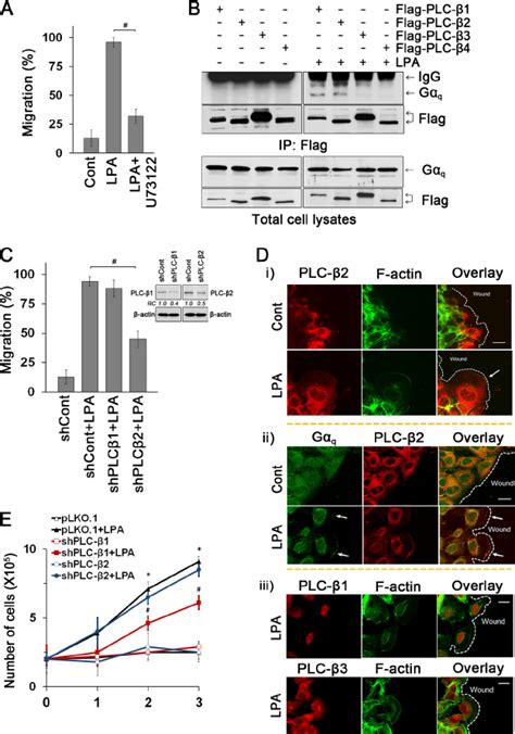 LPA 1 mediates cell migration and proliferation via distinct PLC ...