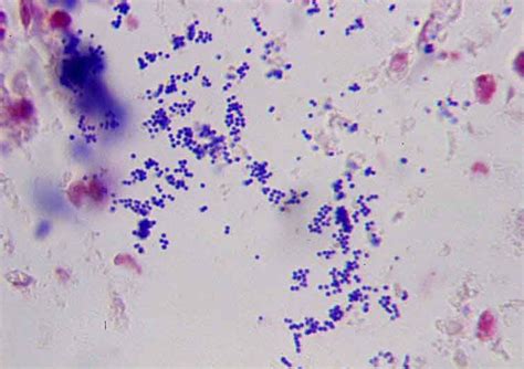 Staphylococcus Epidermidis Gram Stain