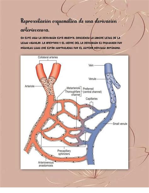 Representaci N Esquem Tica De Una Derivaci N Arteriovenosa Udocz