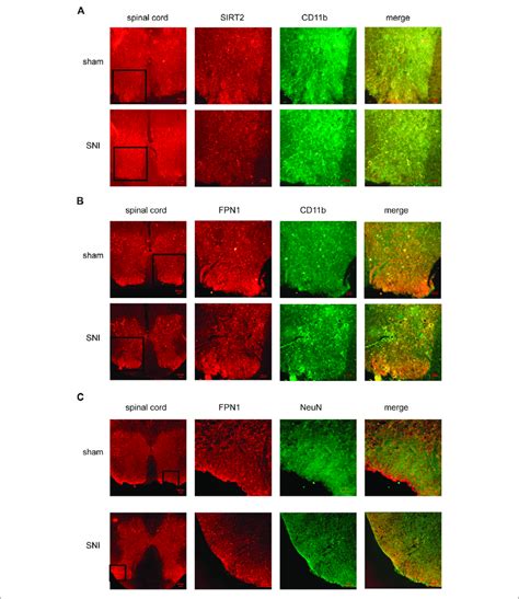 The Cellular Localization Of Sirt And Fpn In The Spinal Cord A