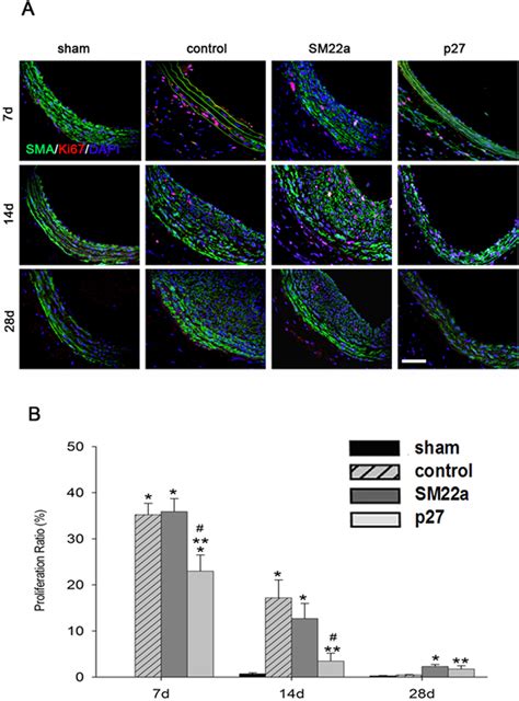 Inhibition Of Neointimal Hyperplasia With Lenti SM22alpha P27