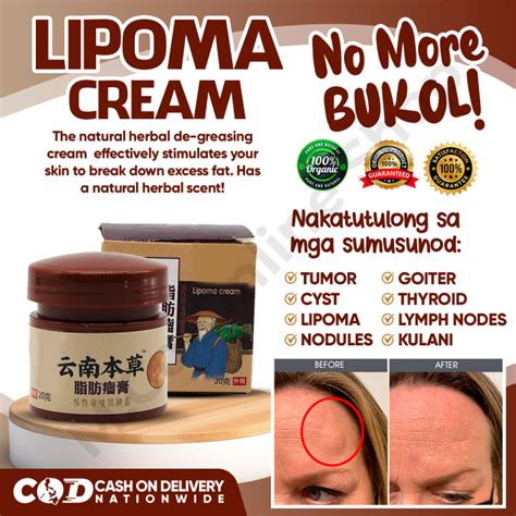 ORIGINAL Fast Effect Lipoma Removal Cream 20g Safe And Effective Treat