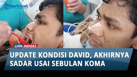 Update Kondisi David Akhirnya Sadar Usai Sebulan Koma Sudah Bisa