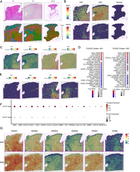 Spatial Transcriptomics Identifies Distinct Regions Of TLS Involvement